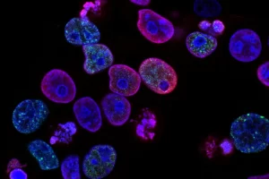 Stem Cell Exosome