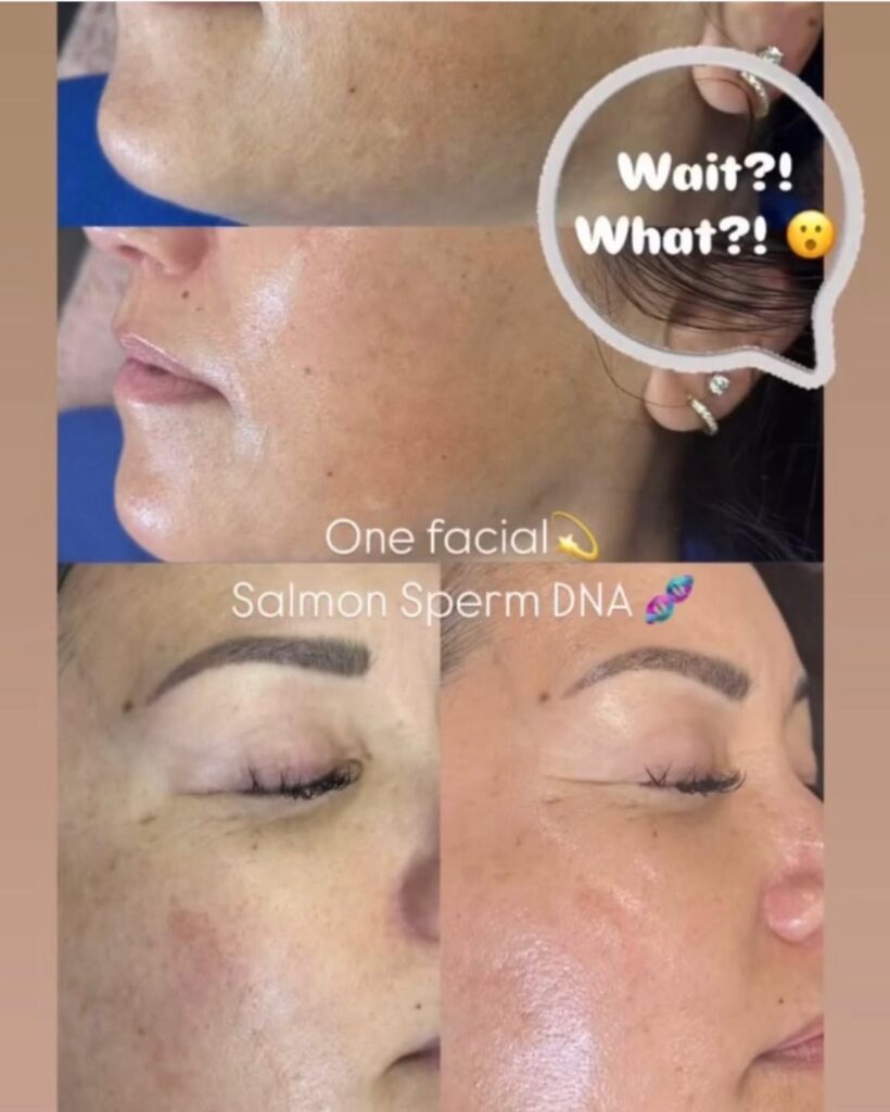 salmon pdrn before and after