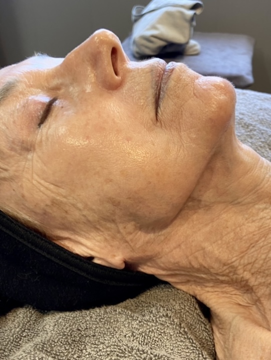 Healthy collagen in skin