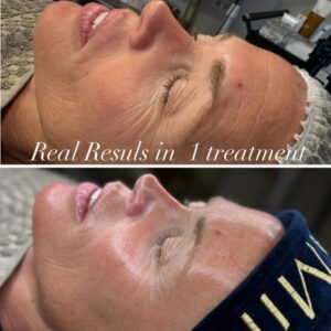 colostrum peel in flagstaff